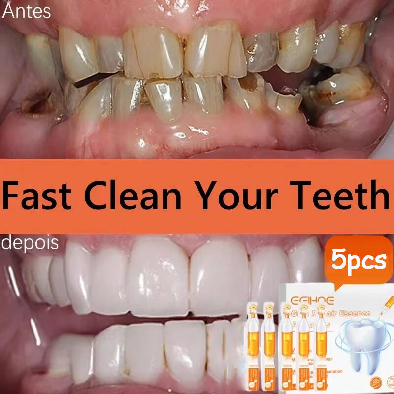 Teeth Whitening With Baking Soda - Sérum de réparation rapide des gencives,