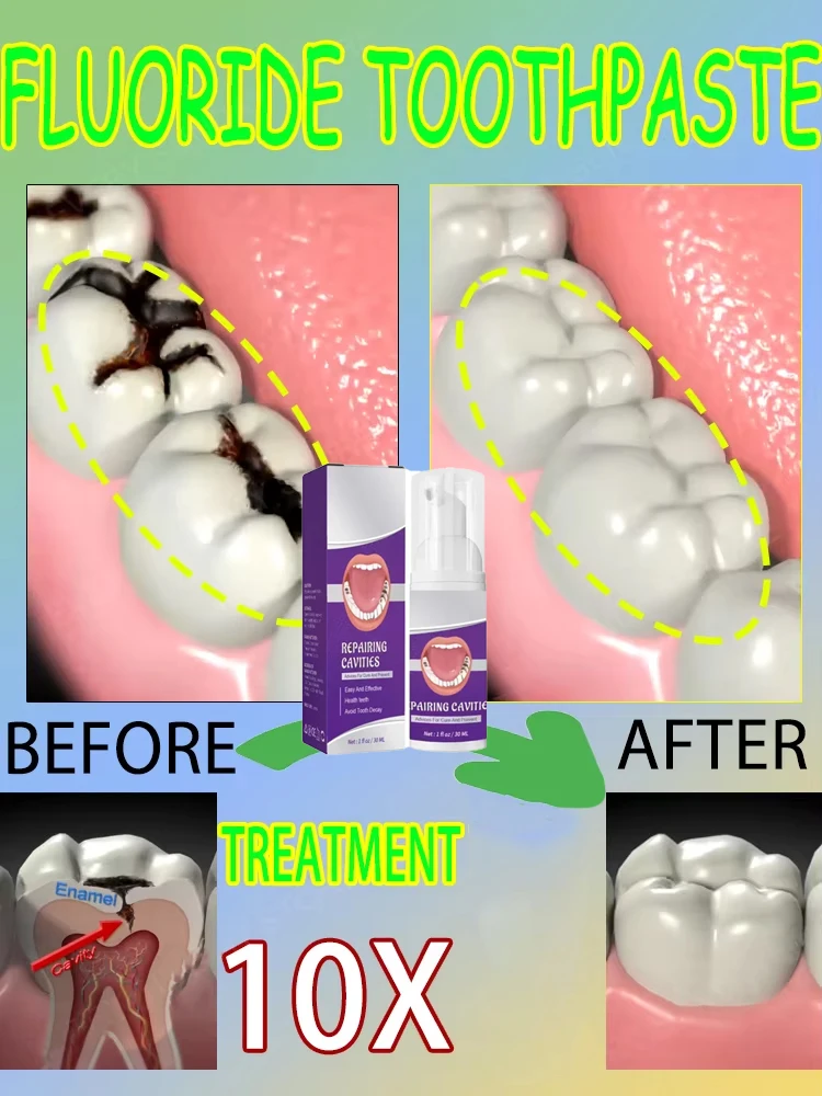 Teeth Whitening That Works - Répare les cavités scientifiques, Élimine les