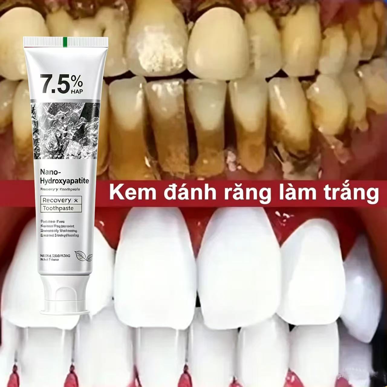 Teeth Whitening That Works - Dentifrice blanchissant probiotique à 7,5 %