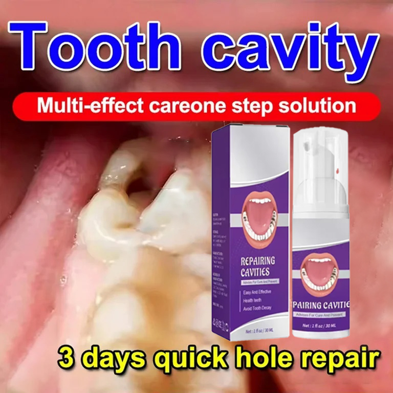 Teeth Whitening That Works - Nettoyage des dents dentifrice élimine les