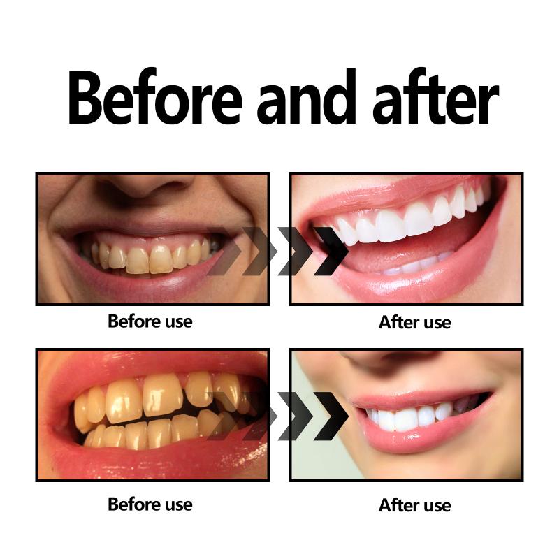 Poudre de blanchiment des dent - Teeth Whitening With Baking Soda avis et prix