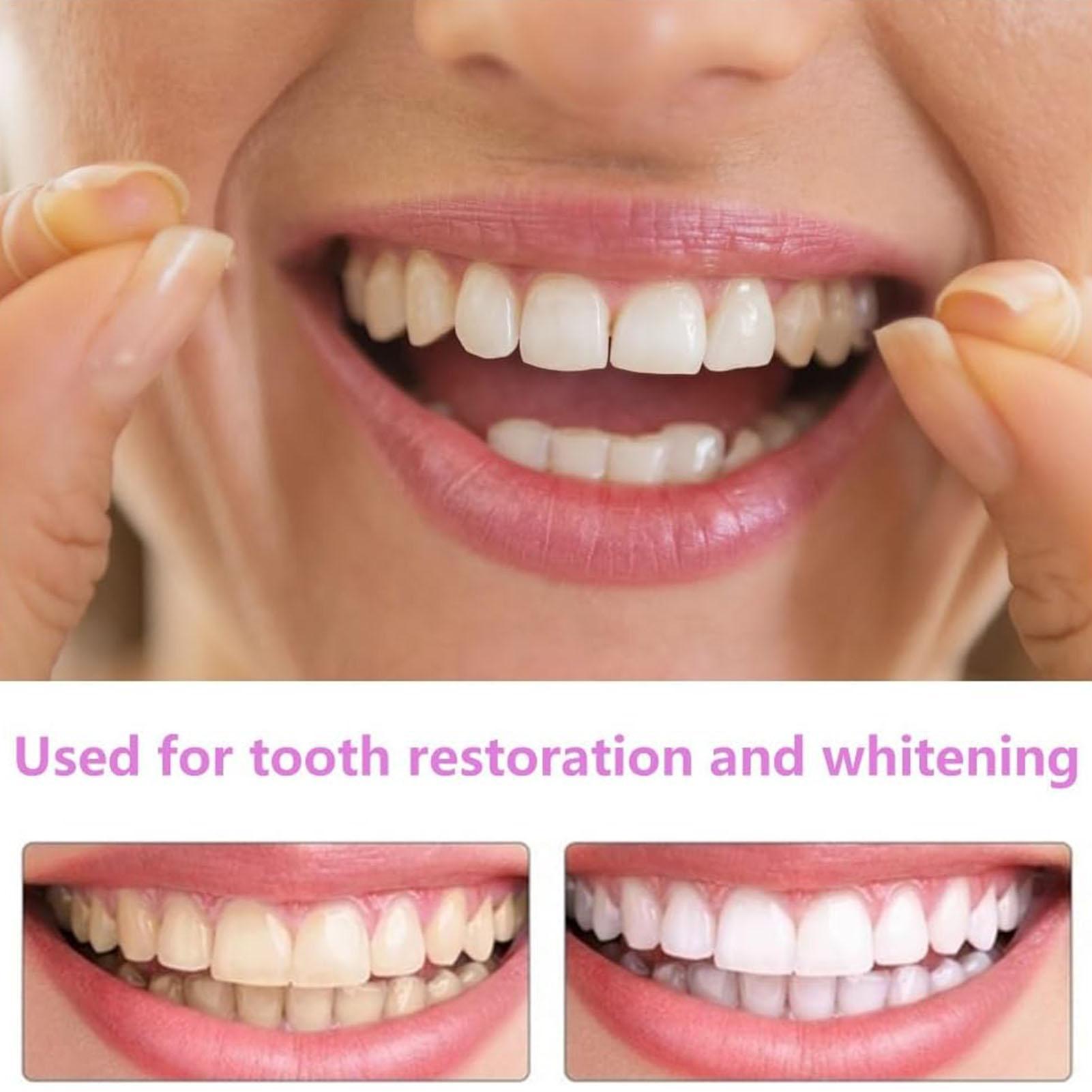 1 paire de placages à Long ter - Teeth Whitening Fast avis et prix