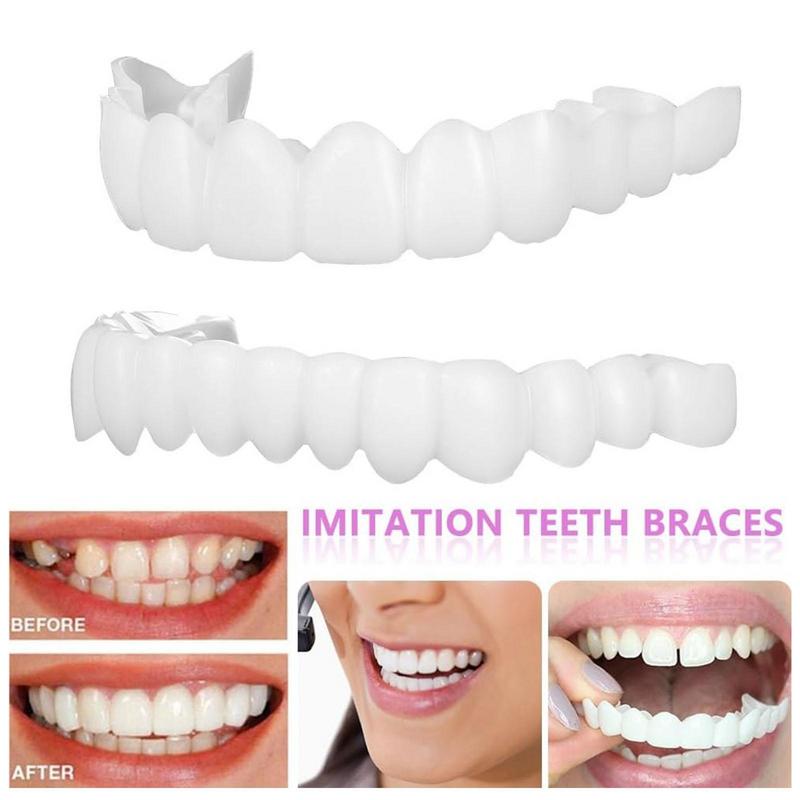 Nouvelles Facettes Dentaires S - Teeth Whitening For Photos avis et prix