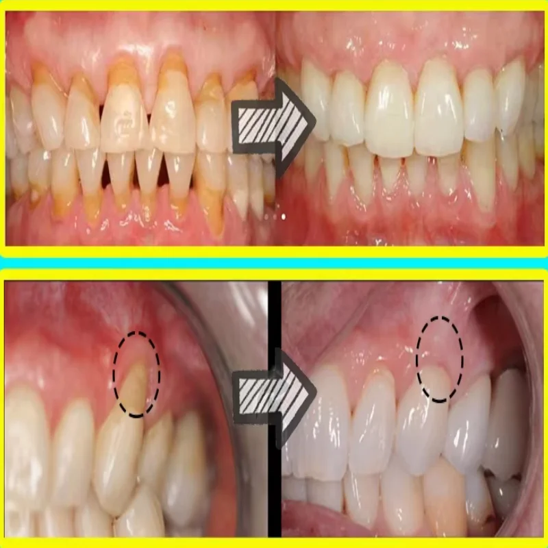 Sérum de réparation rapide des - Teeth Whitening With Baking Soda avis et prix