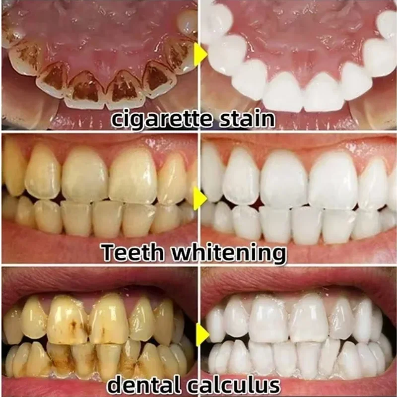 Sérum de réparation rapide des - Teeth Whitening With Baking Soda avis et prix