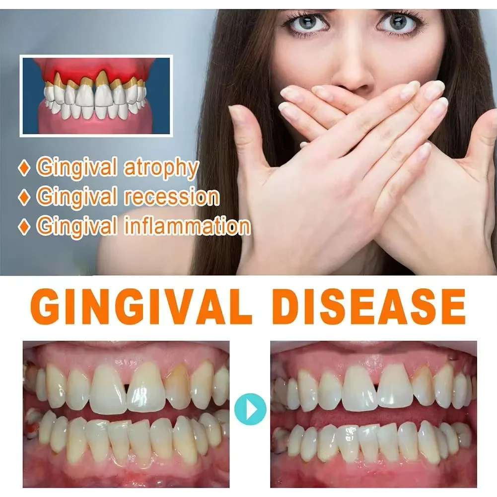 Sérum de réparation rapide des - Teeth Whitening With Baking Soda avis et prix