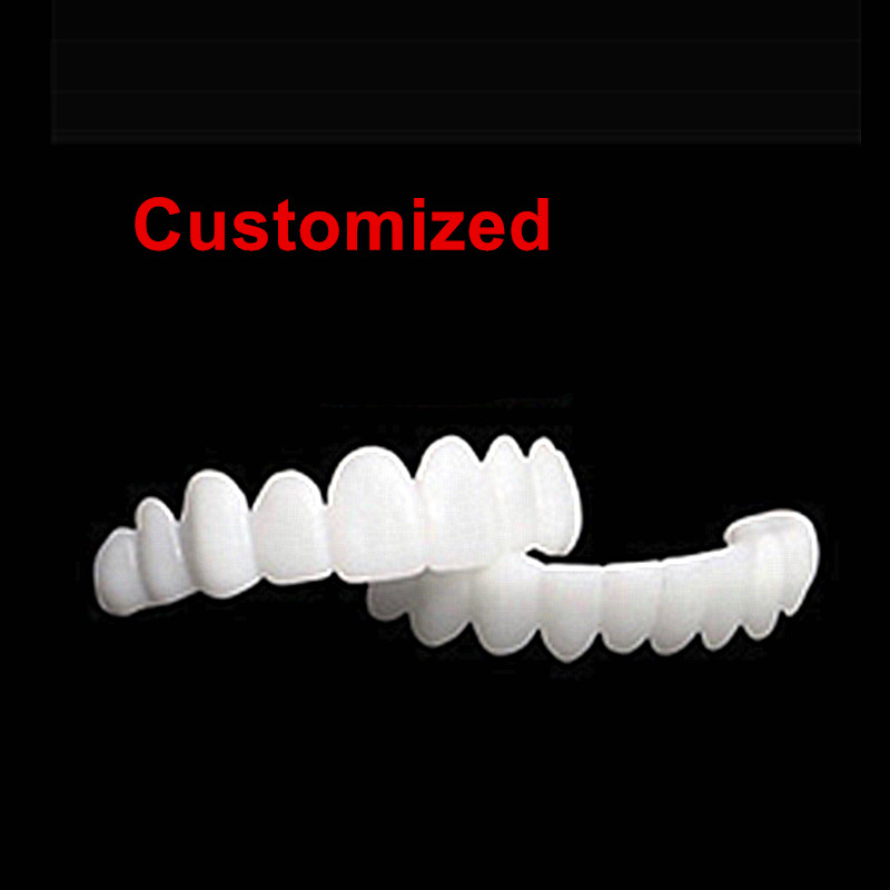 Nouvelles Facettes Dentaires R - Teeth Whitening For Photos avis et prix