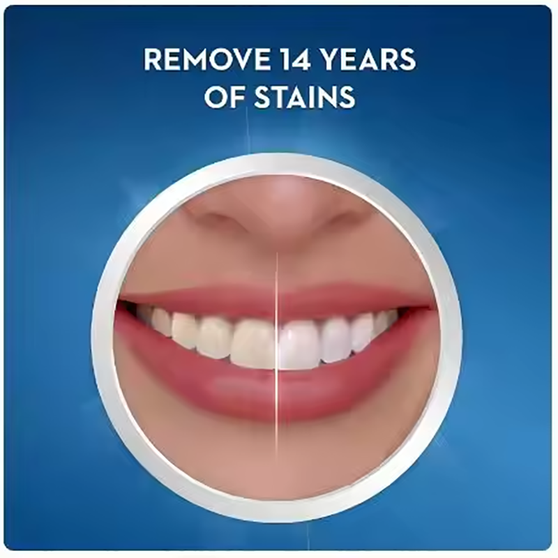 Crest bandes de blanchiment de - Teeth Whitening Effects avis et prix