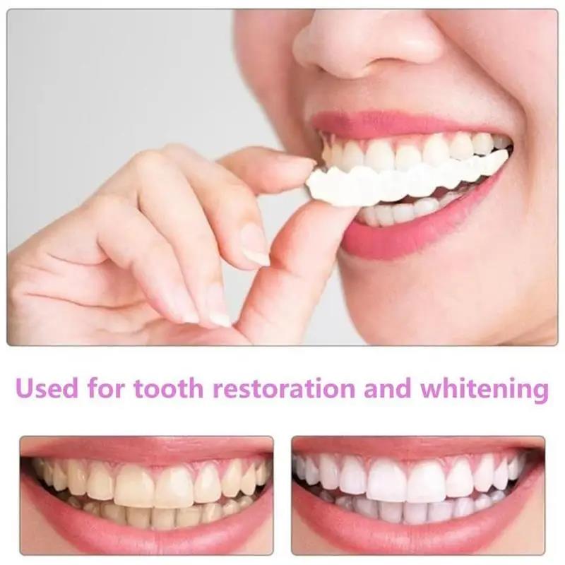 Nouvelles Facettes Dentaires R - Teeth Whitening For Photos avis et prix