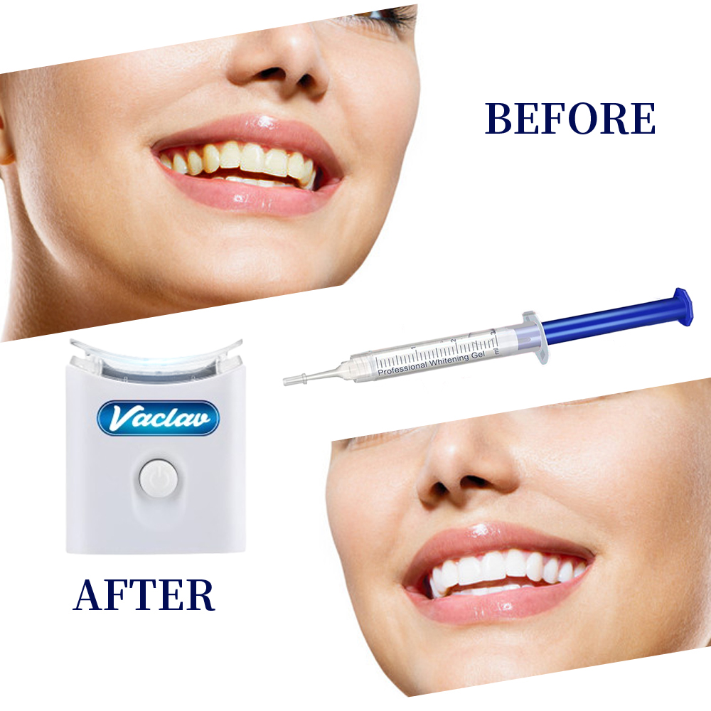 Seringue de Gel de blanchiment - Teeth Whitening With Baking Soda avis et prix