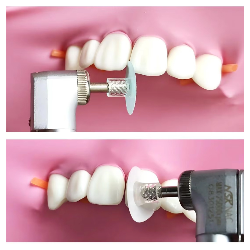 40 disques de polissage dentai - Teeth Whitening Uk avis et prix