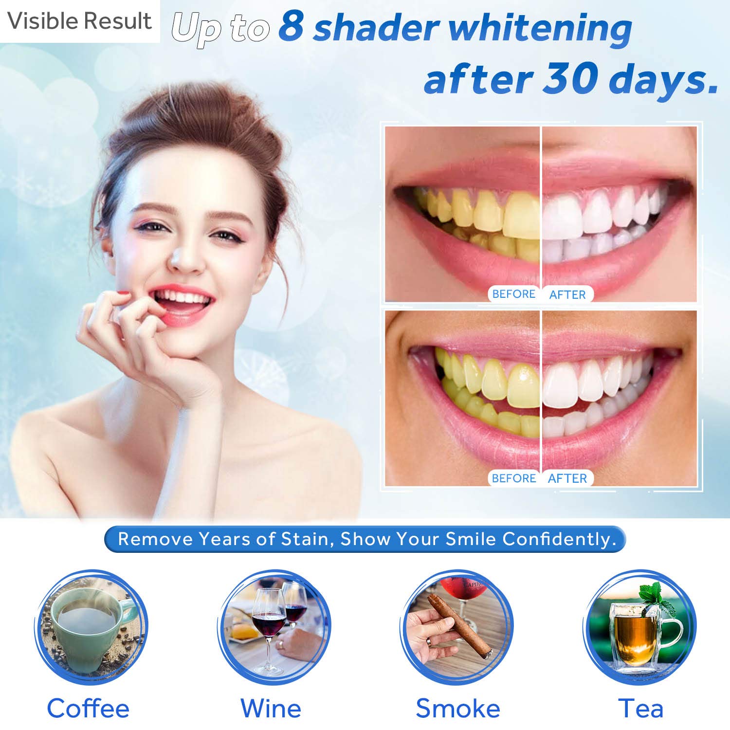 Gel de blanchiment des dents r - Teeth Whitening Hismile avis et prix