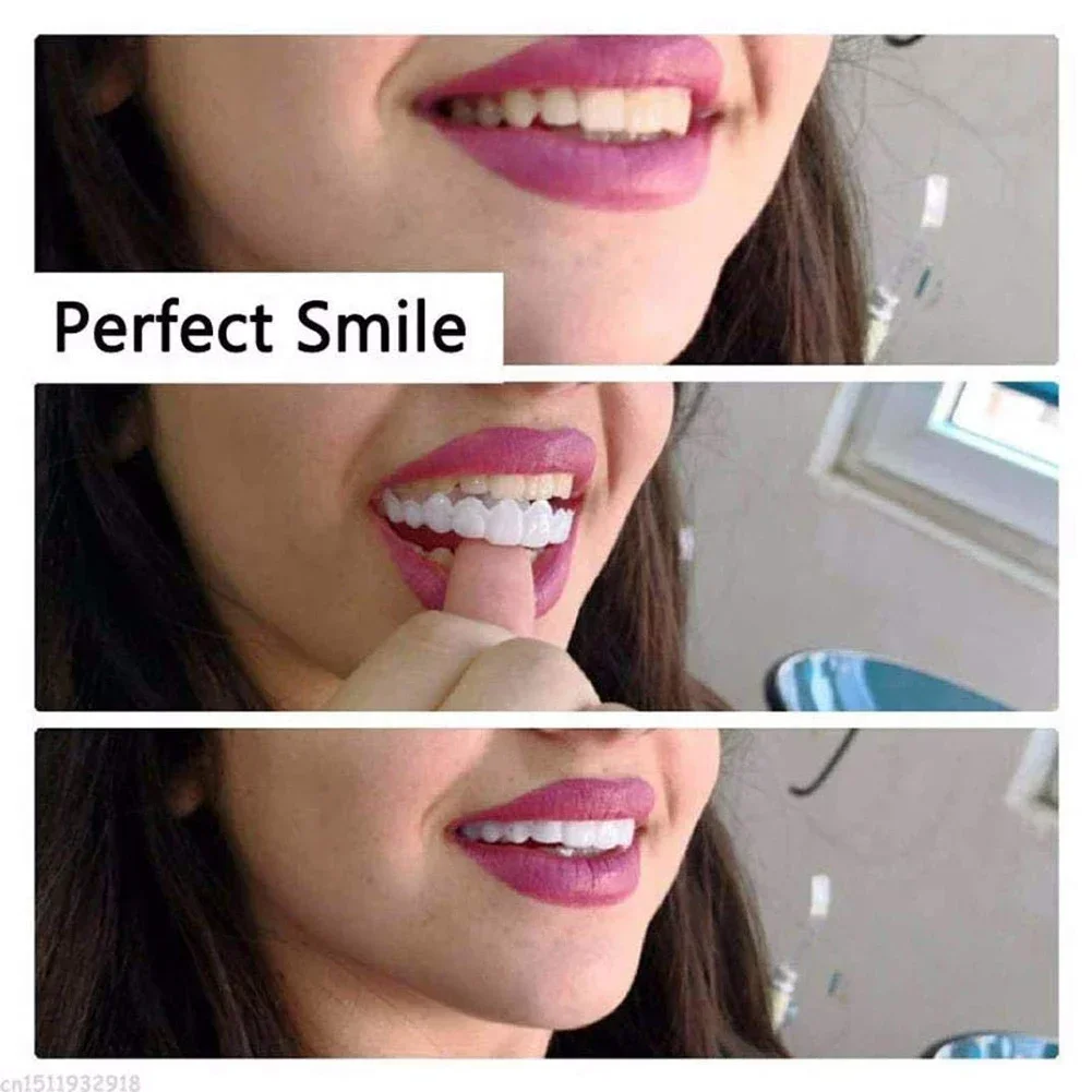 Veneers dentaires réutilisable - Teeth Whitening For Photos avis et prix