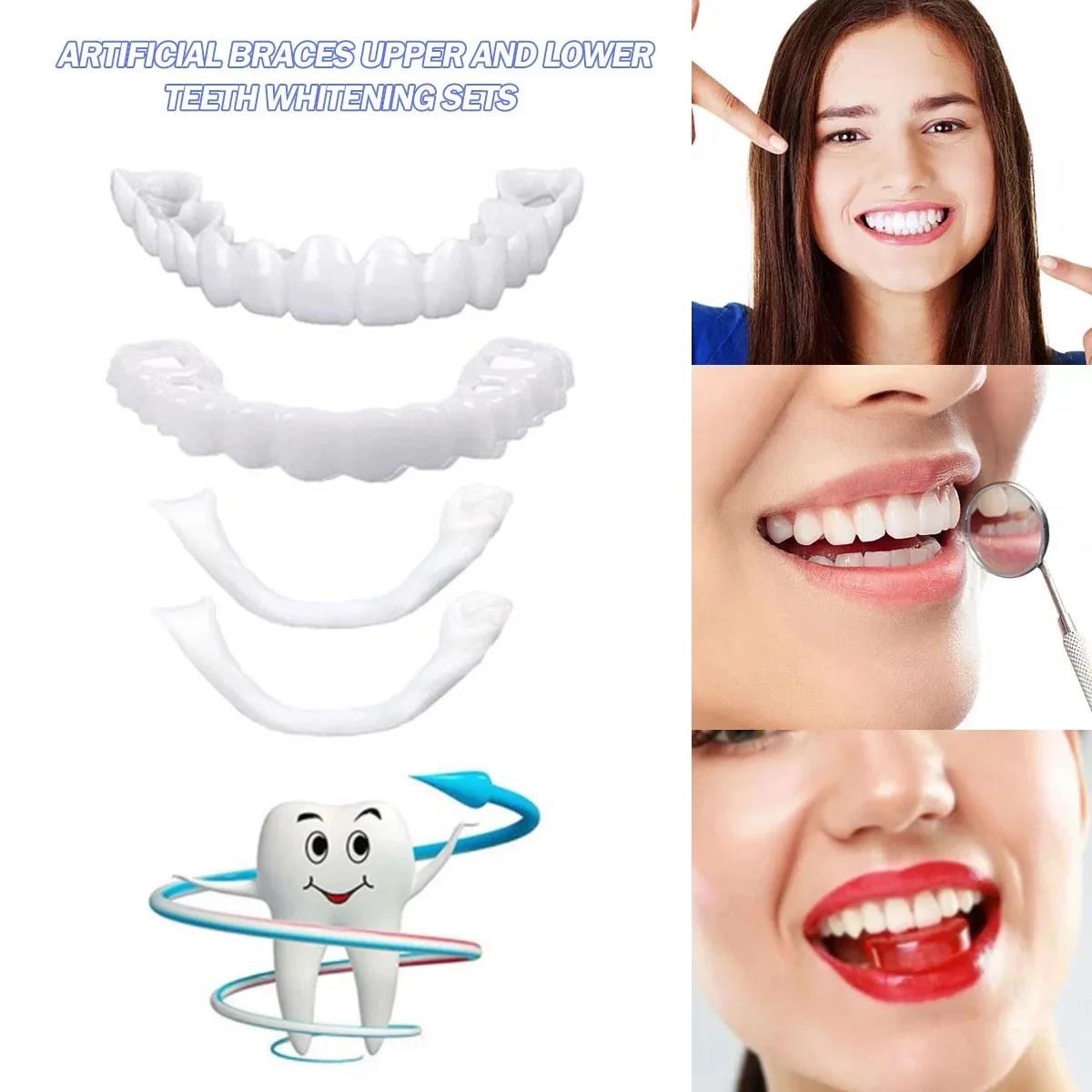 Nouvelles Facettes Dentaires S - Teeth Whitening For Photos avis et prix