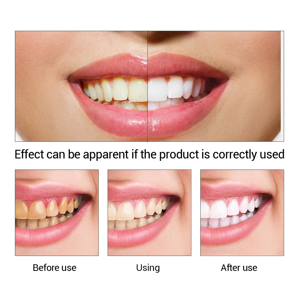 FTEENPLY poudre d'essence de b - Teeth Whitening Hismile avis et prix