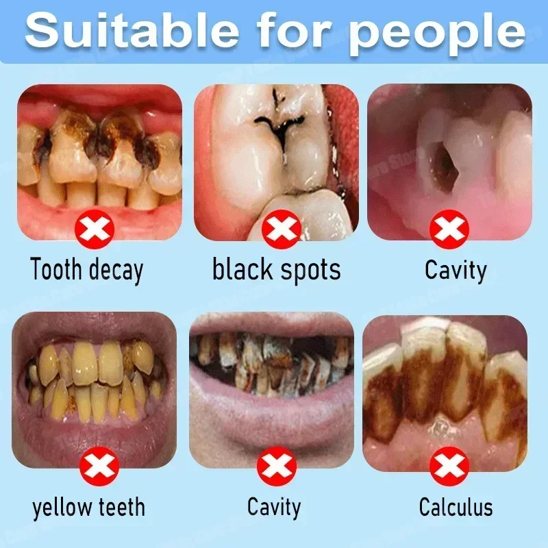 Dentifrice anti-caries : répar - Teeth Whitening That Works avis et prix