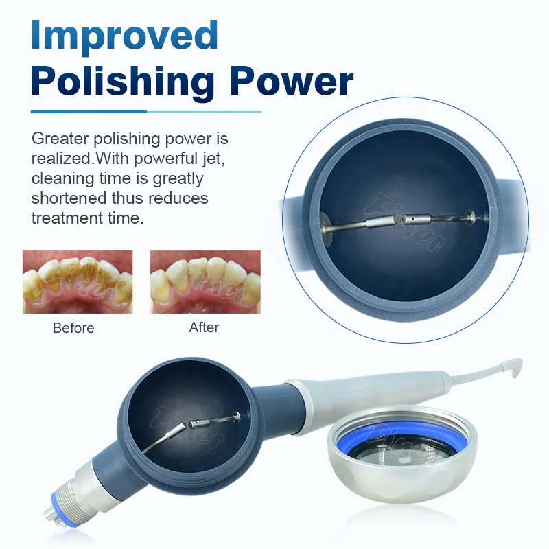 Prophy Mate nettoyage des dent - Teeth Whitening Fast avis et prix