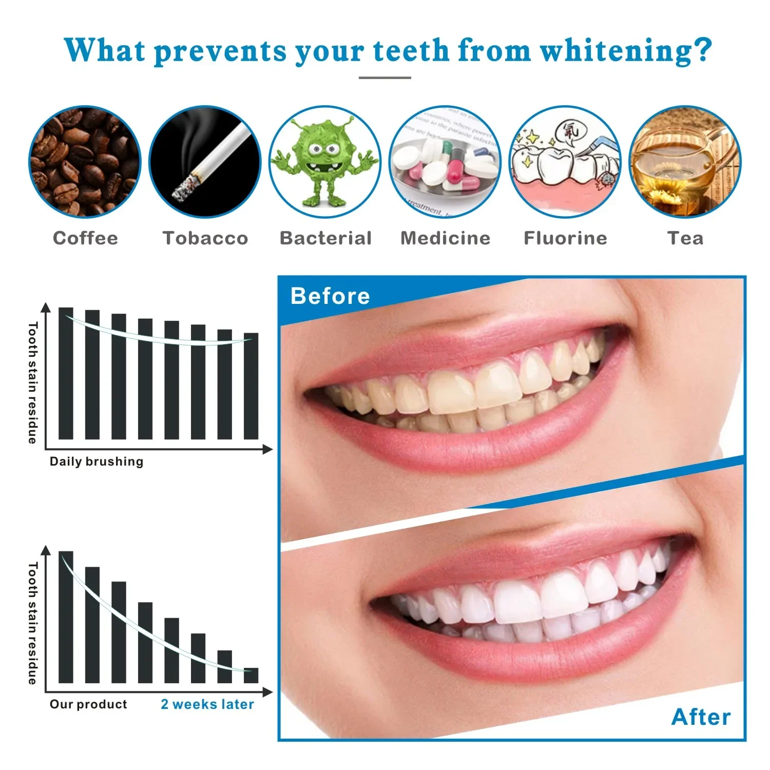 14/28 pièces 3D bandes de blan - Teeth Whitening Effects avis et prix