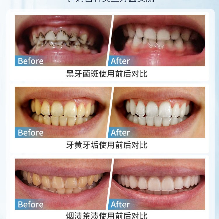 Brosse manuelle japonaise pour - Teeth Whitening In Japan avis et prix