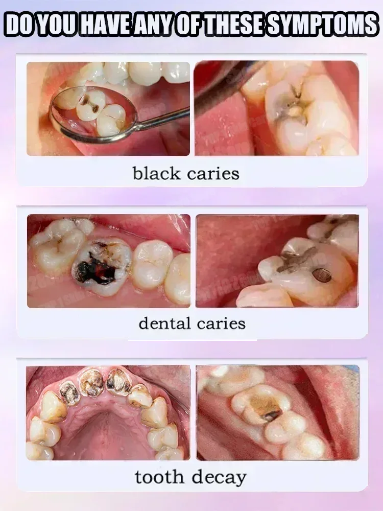 Offres spéciales Best-seller,  - Teeth Whitening That Works avis et prix
