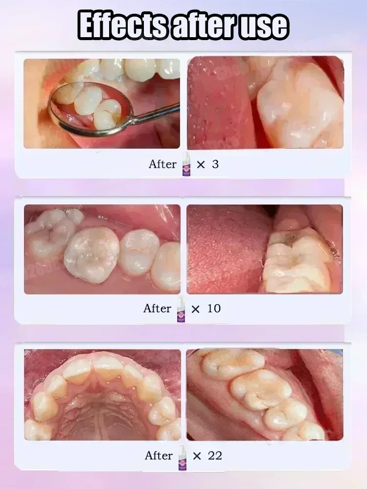 Répare les cavités scientifiqu - Teeth Whitening That Works avis et prix
