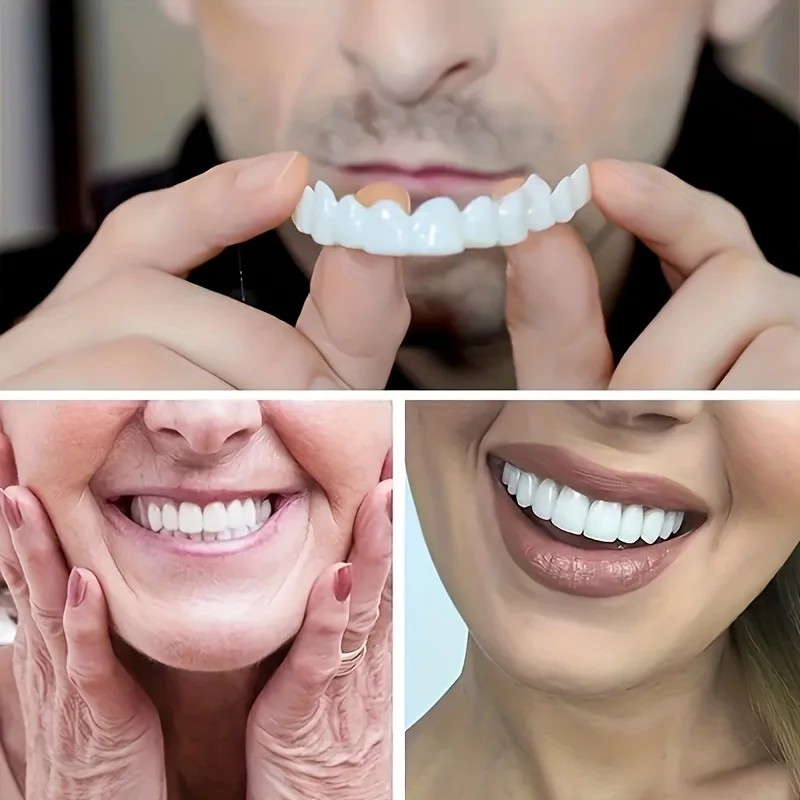 Nouvelles Facettes Dentaires S - Teeth Whitening For Photos avis et prix