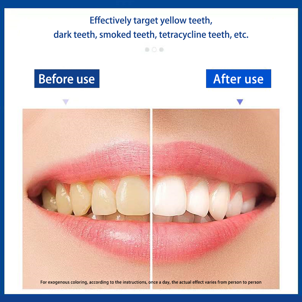 70/140 paires 5D bandes de bla - Teeth Whitening Effects avis et prix
