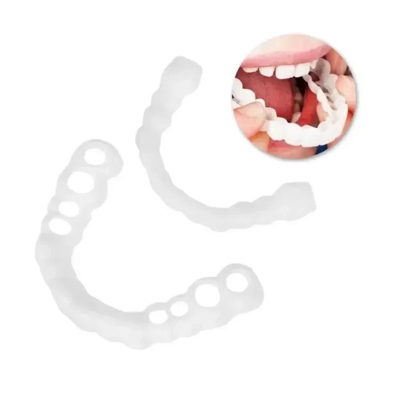 Nouvelles Facettes Dentaires R - Teeth Whitening For Photos avis et prix