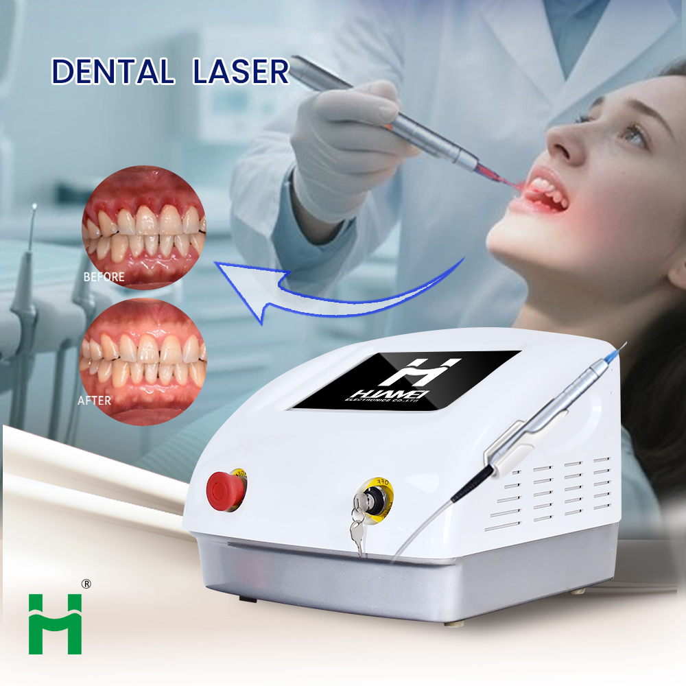Kit de blanchiment des dents L - Teeth Whitening Bleaching Kit avis et prix