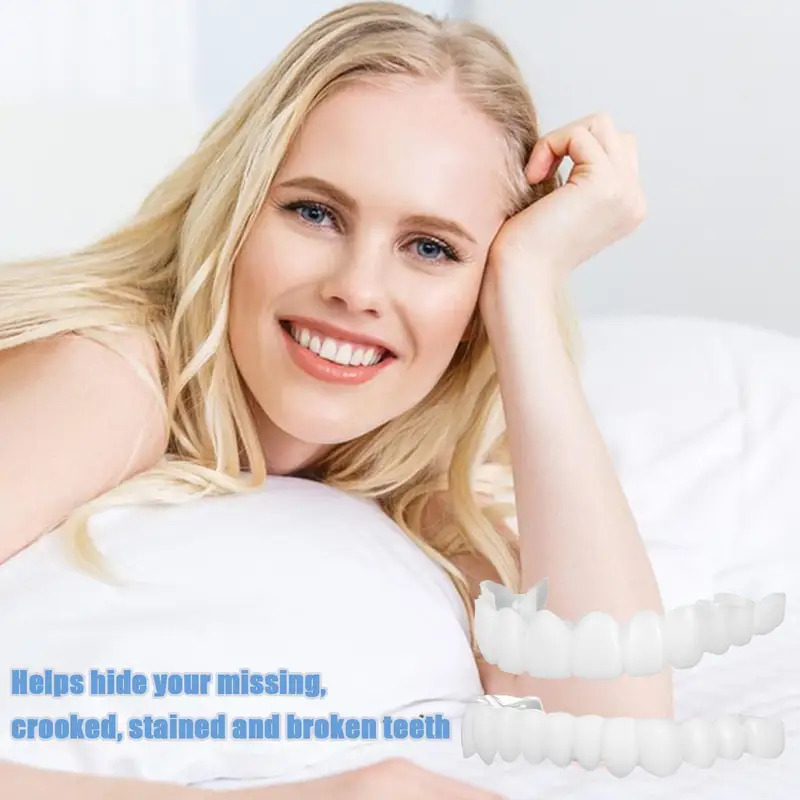 Nouvelles Facettes Dentaires R - Teeth Whitening For Photos avis et prix