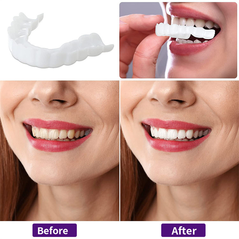 Nouvelles Facettes Dentaires S - Teeth Whitening For Photos avis et prix