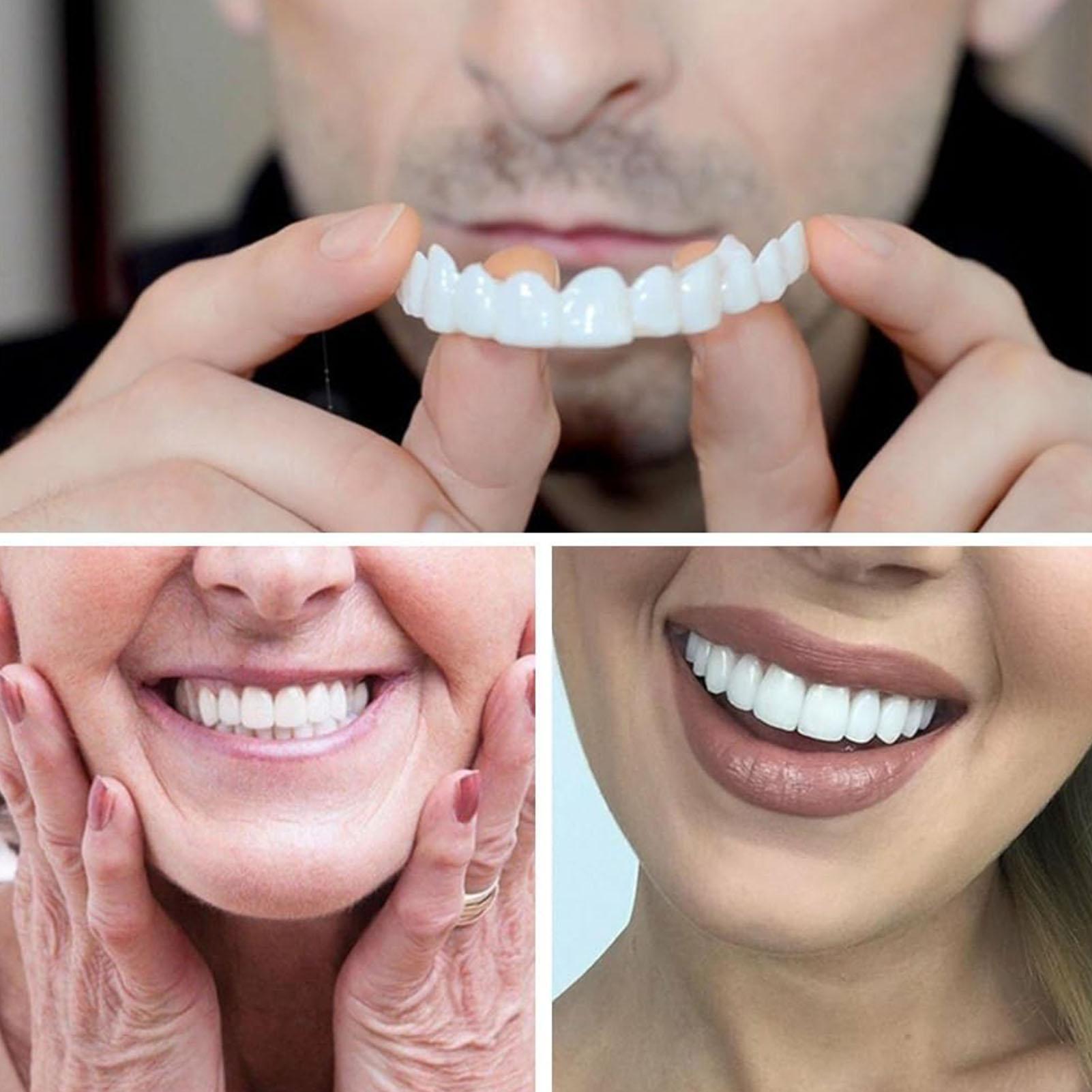 Nouvelles dentières esthétique - Teeth Whitening For Photos avis et prix