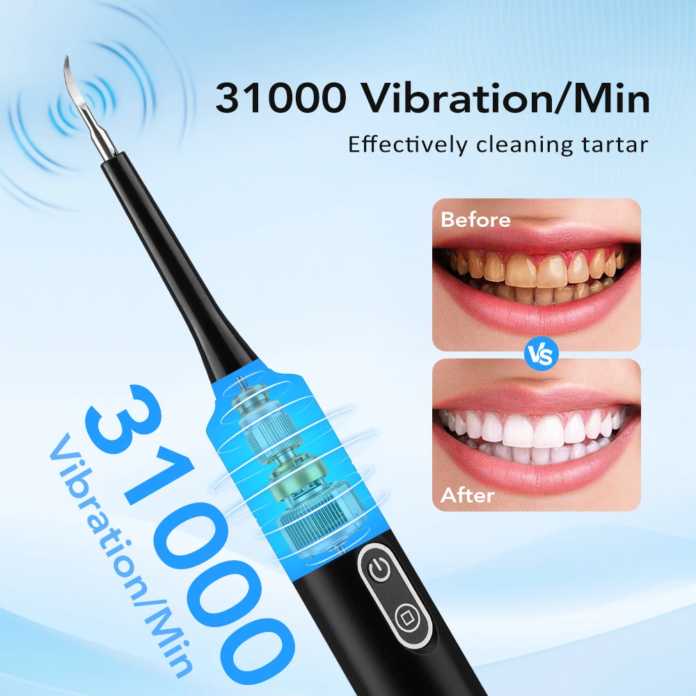 Détartreur dentaire électrique - Teeth Whitening Uk avis et prix